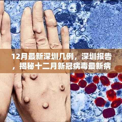 深圳报告揭秘,十二月新冠病毒最新病例分析与数据更新
