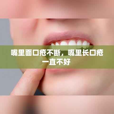 嘴里面口疮不断,嘴里长口疮一直不好