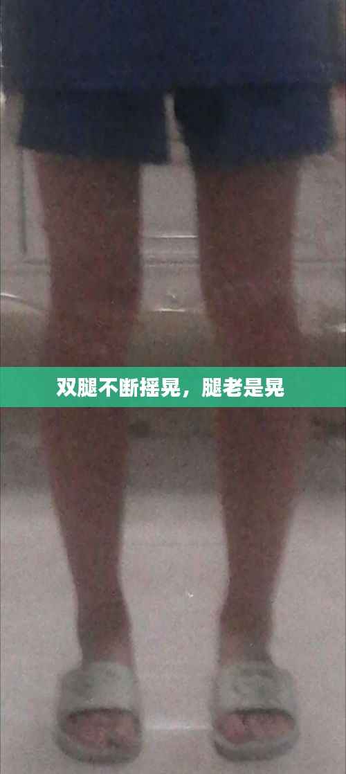 双腿不断摇晃，腿老是晃 